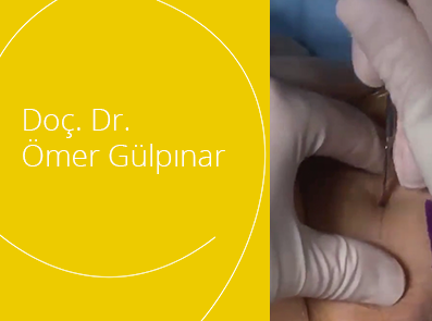 Doç. Dr. Ömer Gülpınar - Üriner İnkontinansta Tension-Free Vaginal Tape (TVT) Operasyonu 